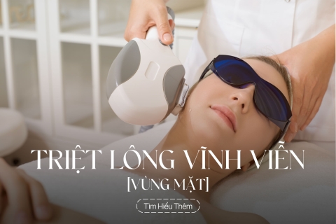 Triệt lông vùng mặt vĩnh viễn
